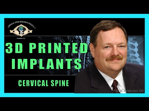 3D Printed Implants for the Cervical Spine - Dr. Paul Anderson