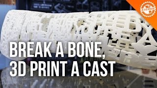 Social, 3D Printed Cast for Broken Bones