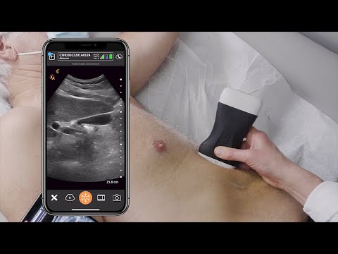 Scanning the Gallbladder