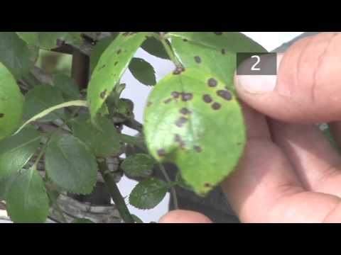 HIV fungus toenails Paa halamang-singaw drawing