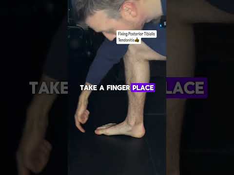 Fixing Posterior Tibialis Tendinitis 👍