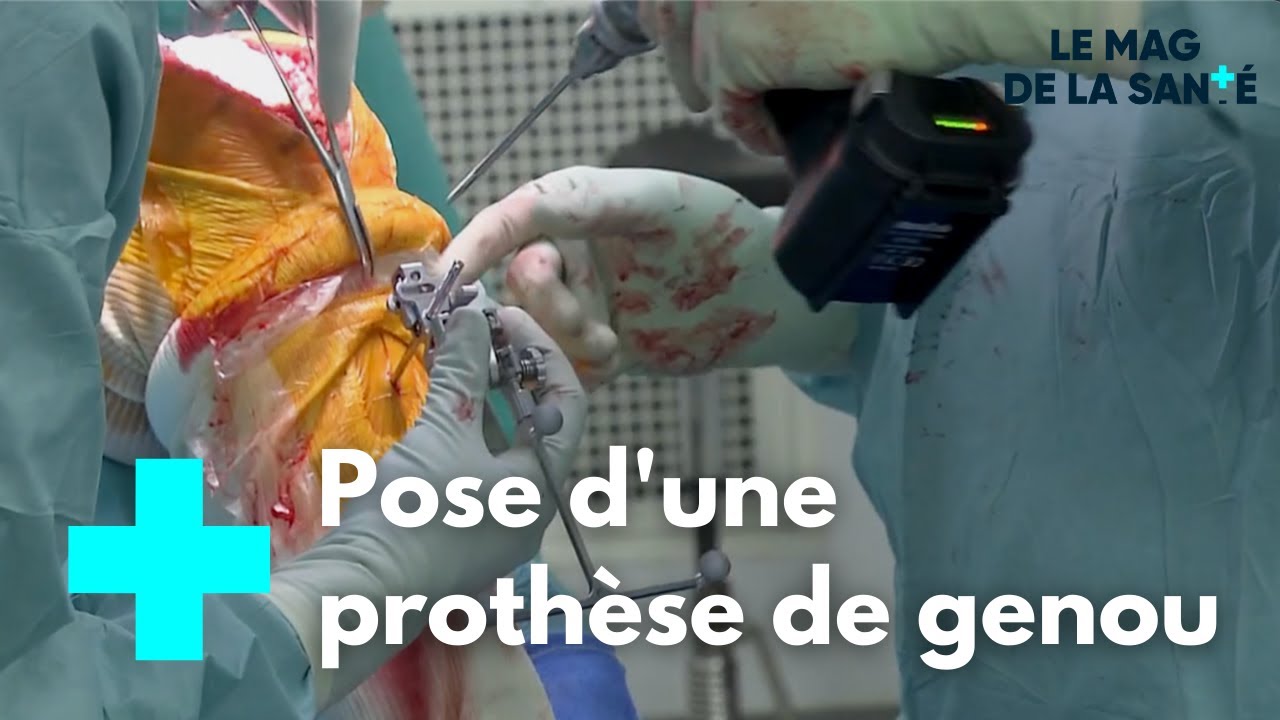 Prothe?se de genou : une chirurgie de haute technologie - Le Magazine de la Santé