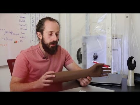 Kostengünstig: Prothesen aus dem 3D-Drucker | Ärzte ohne Grenzen