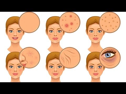 Posizione di eczema di salute Come curare leczema che sta a bambini