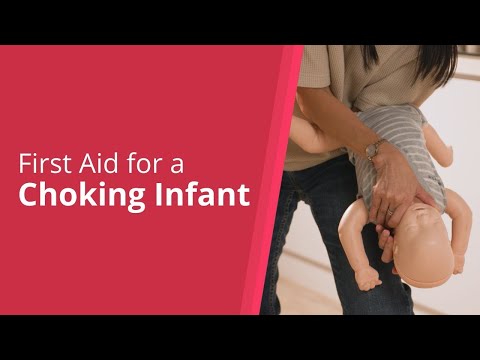 First Aid For A Choking Infant