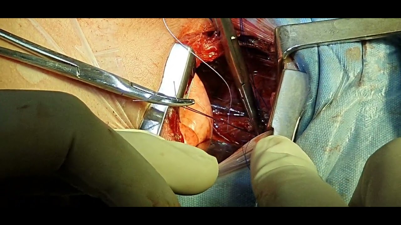 Agustin Bejar Martinez-20