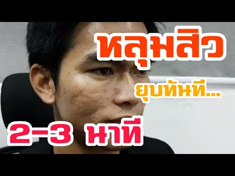 น้ำมันเข็มเฟอร์จากหัวโรคสะเก็ดเงิน โรคสะเก็ดเงินที่ขาหนีบจะทำอย่างไร