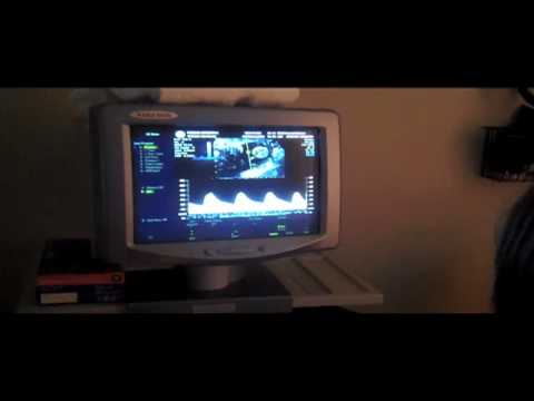 Ultrasound Growth Scan- 29 Weeks