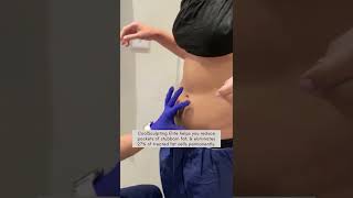 What happens during a CoolSculpting Fat Freezing procedure | The Cosmetic Skin Clinic