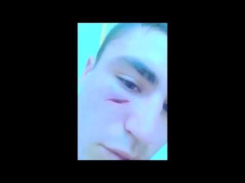 EL FRODO - KASTIGAO DE AMOR