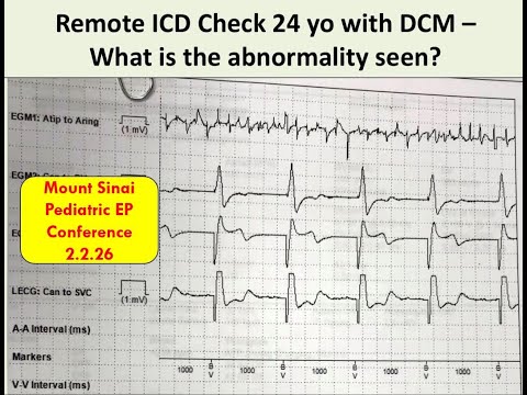 Mount Sinai Pediatric EP Conference - 2.2.96