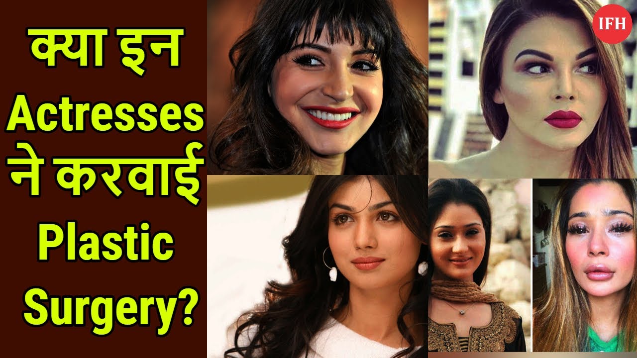 क्या इन Actresses ने करवाई है Lips की Plastic Surgery
