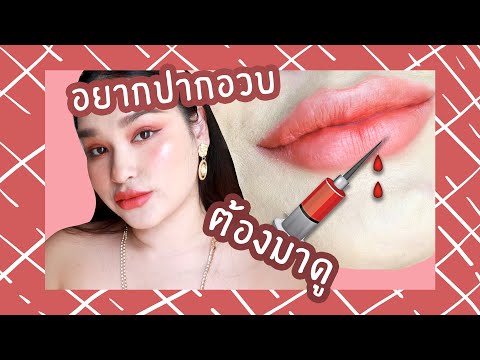 ฉีด ฟิลเลอร์ ปาก
