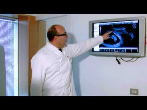 Dellanca nei neonati dellacetabolo norma Osteocondrosi collare galvanica