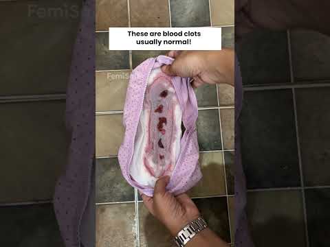 This is completely normal and there's nothing to worry about...😊 | FemiSafe #periods #bloodclots
