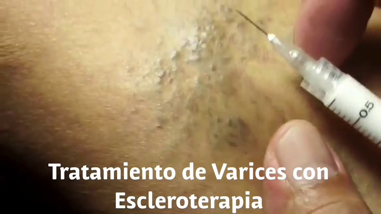 David F. Corrales Sánchez-12