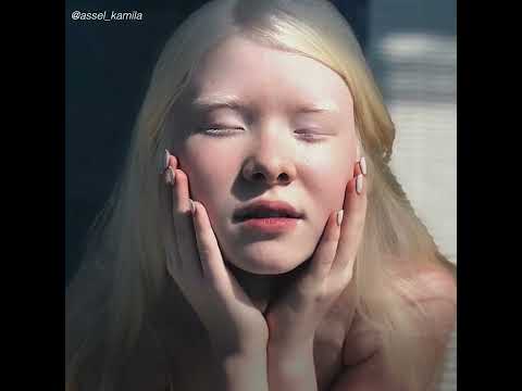 Albino Sisters Become Popular Models