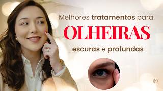 Melhores TRATAMENTOS para OLHEIRAS escuras e profundas!