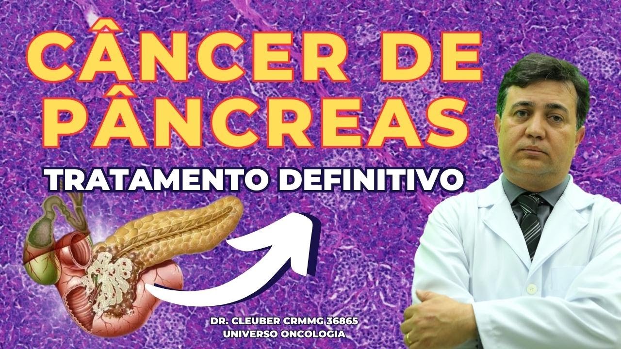 CÂNCER DE PÂNCREAS: Tratamento DEFINITIVO