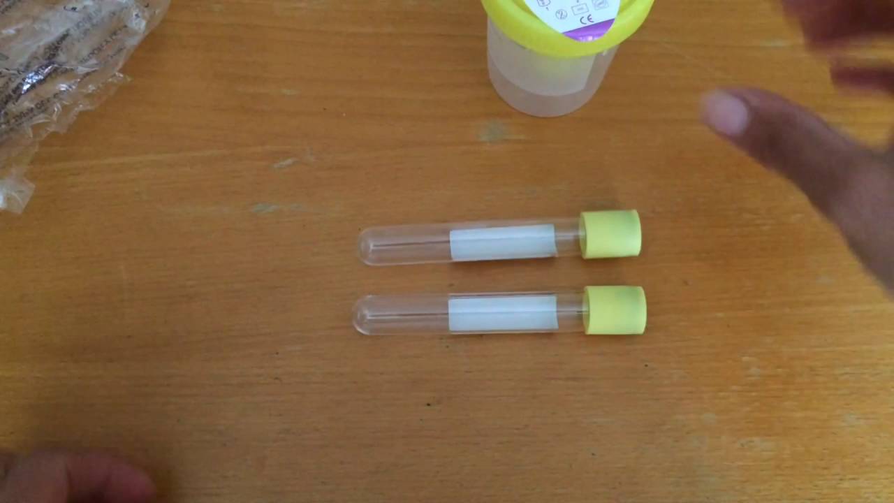 Sistema de recogida de orina