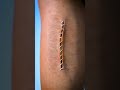 How Stitches Work ๐ฏ - Zack D. Films How Stitches Work ๐ฏ