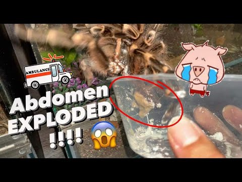 HER ABDOMEN EXPLODED !!!  *EMERGENCY*