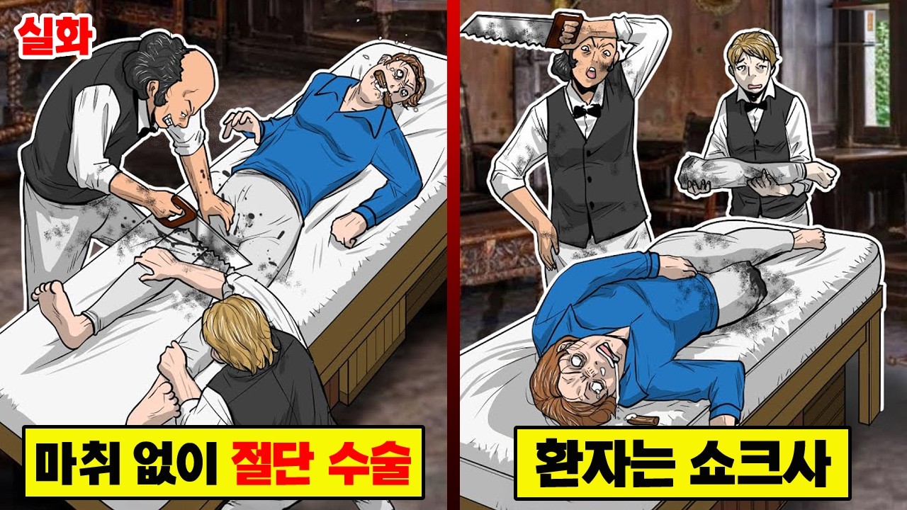 【실화】 300% 환자가 사망... 마취 없는 수술의 결과