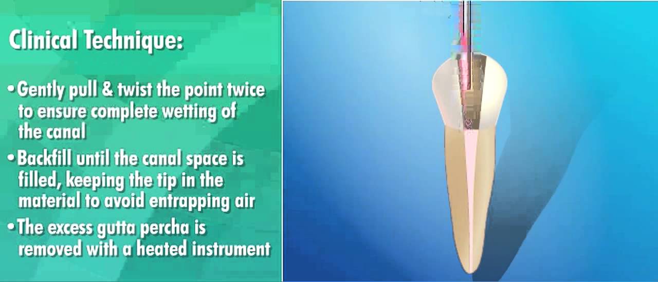 Le GuttaFlow de Roeko