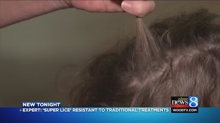 Experts: ‘Super lice’ resistant to traditional treatments