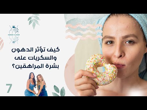 فيديو | كيف تؤثر الدهون والسكريات على بشرة المراهقين؟ - هنادي وليان - الحلقة ٧