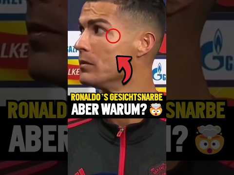 Wunde auf Ronaldos Gesicht – Warum? 🤯😱 #shorts #Fußball #Ronaldo