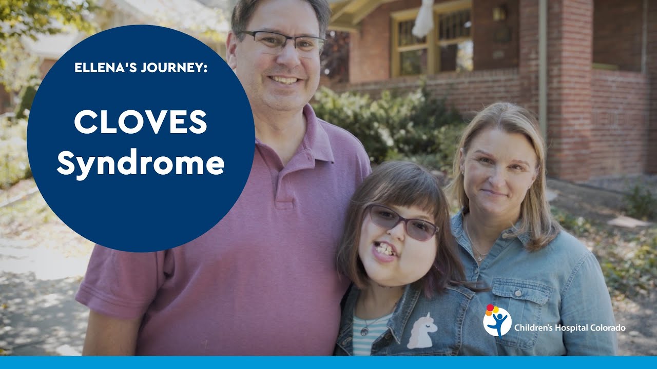 What is clove syndrome? More REF