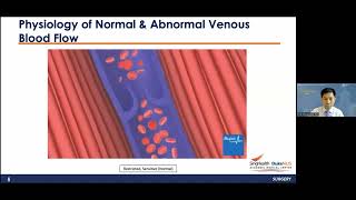 All About Varicose Veins: From Exploration To Management
