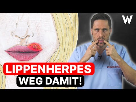 Lippenherpes: Wieso kommt Herpes immer wieder? Behandlung & Vorbeugung von Herpesbläschen | Ursachen