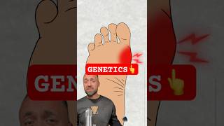 4 Hidden Genes That Cause Bunions