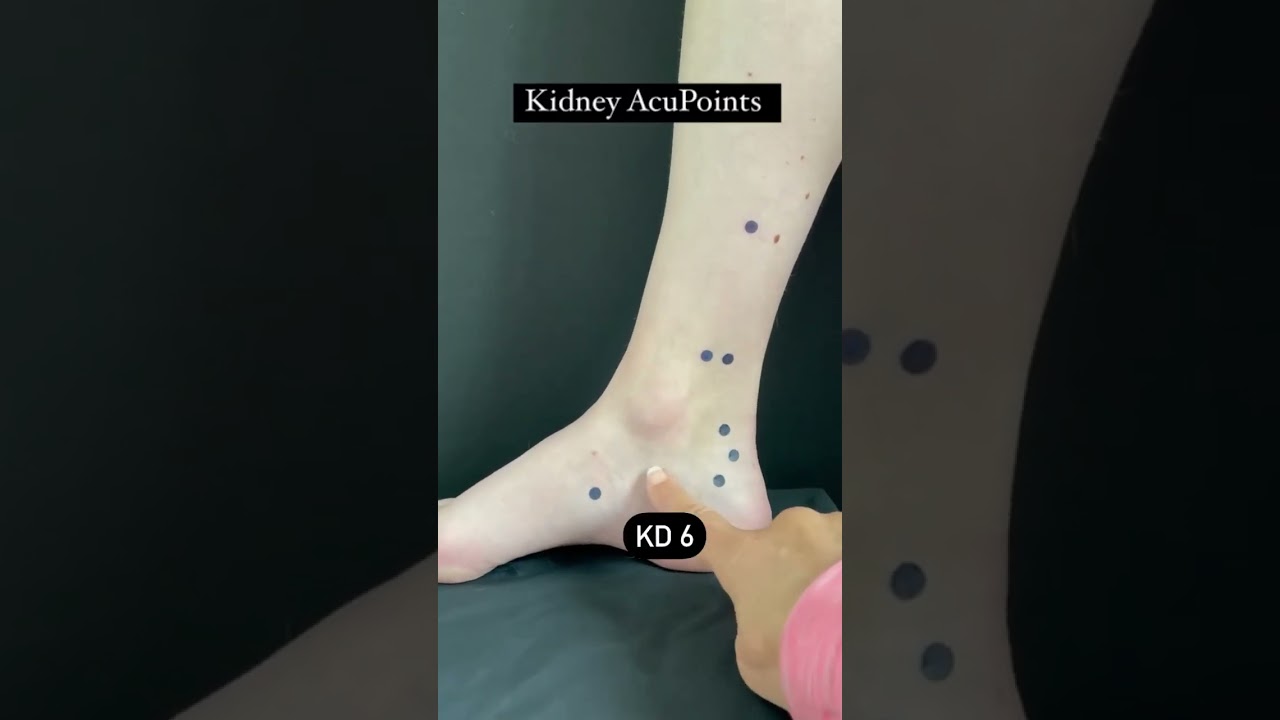 Kidney Meridian Acupuncture Points #acupuncture