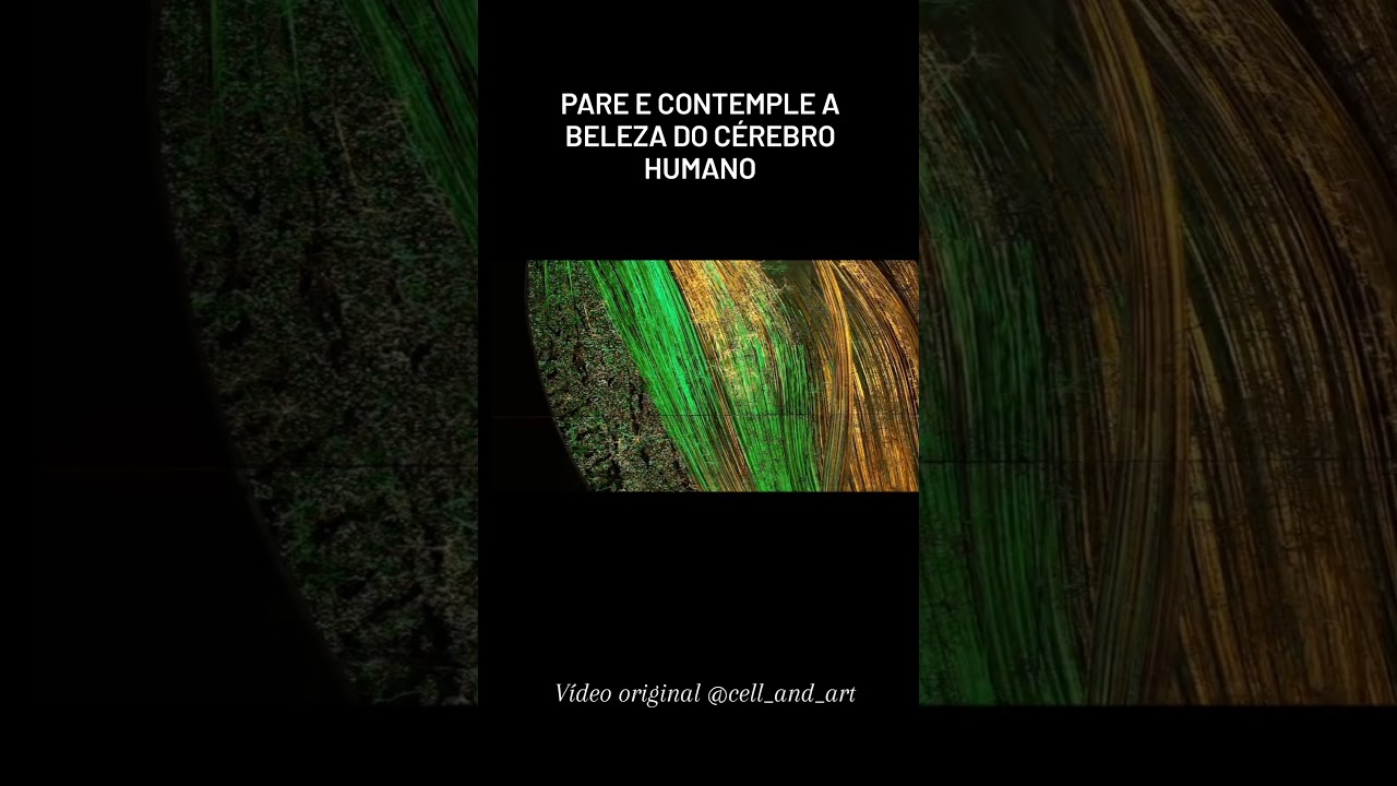 Beleza da atividade do cérebro! #neuroexplica #fonoaudiologianeurofuncional