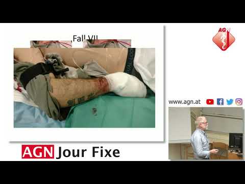 Blutstillung Fallberichte - Gerhard Prause