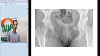 Radiology Spotters 29 - Gorham Stout Disease