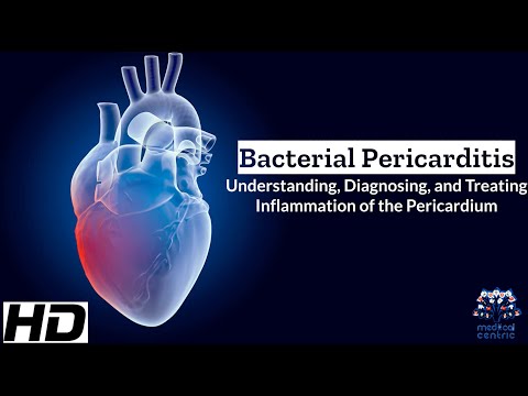 Myocardial Infarction Causes Signs and Symptoms Diagnosis and Treatment