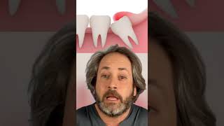 ¿Te están saliendo las MUELAS DEL JUICIO con DOLOR ¿incluso tienes la ENCÍA INFLAMADALo EXPLICO