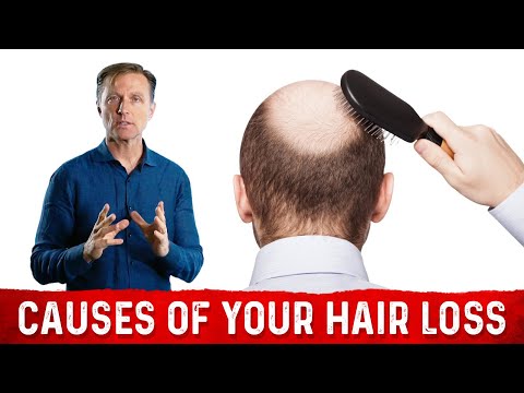 The Underlying Root Cause Of Hair Loss – Treatment For Hair Loss Dr. Berg