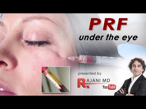 PRF Under Eye Video