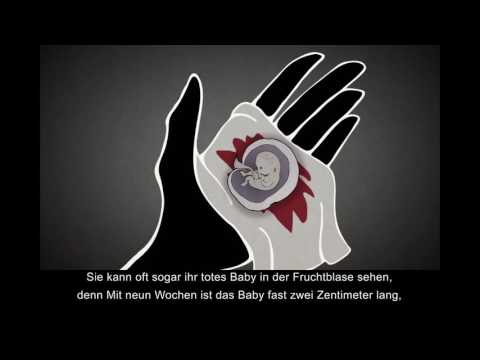 Rückenschmerzen in der Schwangerschaft Rückenschmerzen bei Mädchen