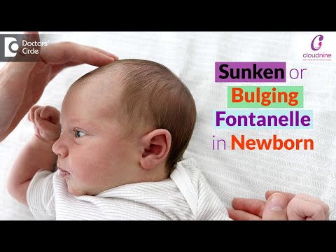 Bulging & Sunken Soft Spots on Baby's Head - Dr.Seema Gaonkar of Cloudnine Hospitals|Doctors' Circle