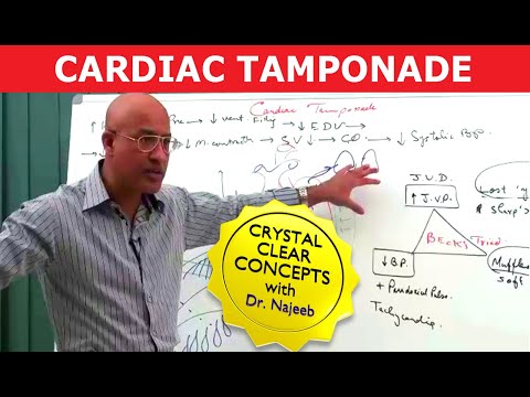 Cardiac Tamponade - Causes, Symptoms & Treatment.