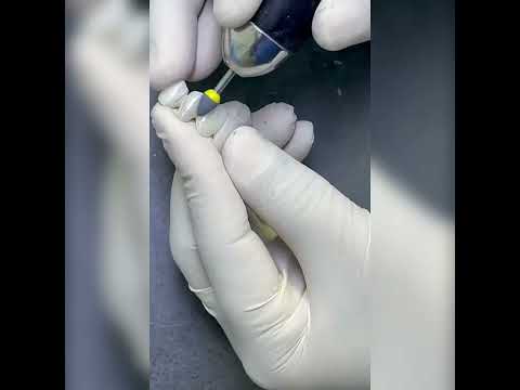 Zolid gen-x Multilayer High Translucent Zircon B1 shade