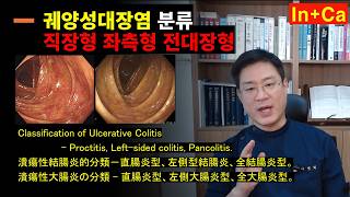 <Entity {'ja': '潰瘍性大腸炎の分類 - 全大腸炎型、左側大腸炎型、直腸炎型。全大腸炎型の治療事例。', 'ko': '궤양성대장염 분류 - 전대장형 좌측형 직장형. 전대장형 치료 사례.', 'en': 'Ulcerative colitis classification - Pancolitis, left-sided colitis, proctitis. Case study of pancolitis treatment.'}>