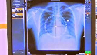 Free Rotation Tool Demo Available on Image Suite and DIRECTVIEW Software