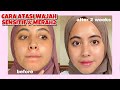SKINCARE AMPUH UNTUK ACNE PRONE SENSITIVE SKIN Pyunkang Yul Calming Line Review